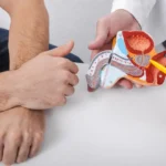 هل يمكن أن يؤدي تضخم البروستاتا إلى ضعف الإنتصاب؟